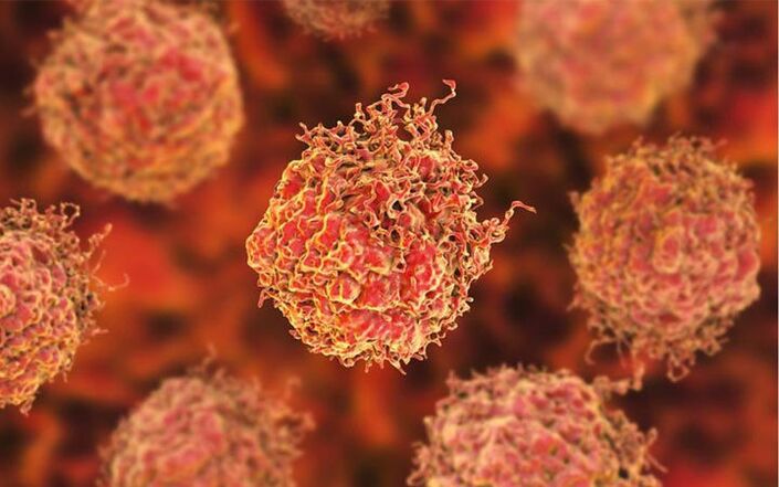 Células cancerosas de próstata